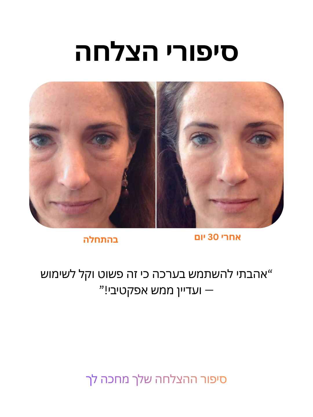 מערכת עירוי מיקרו