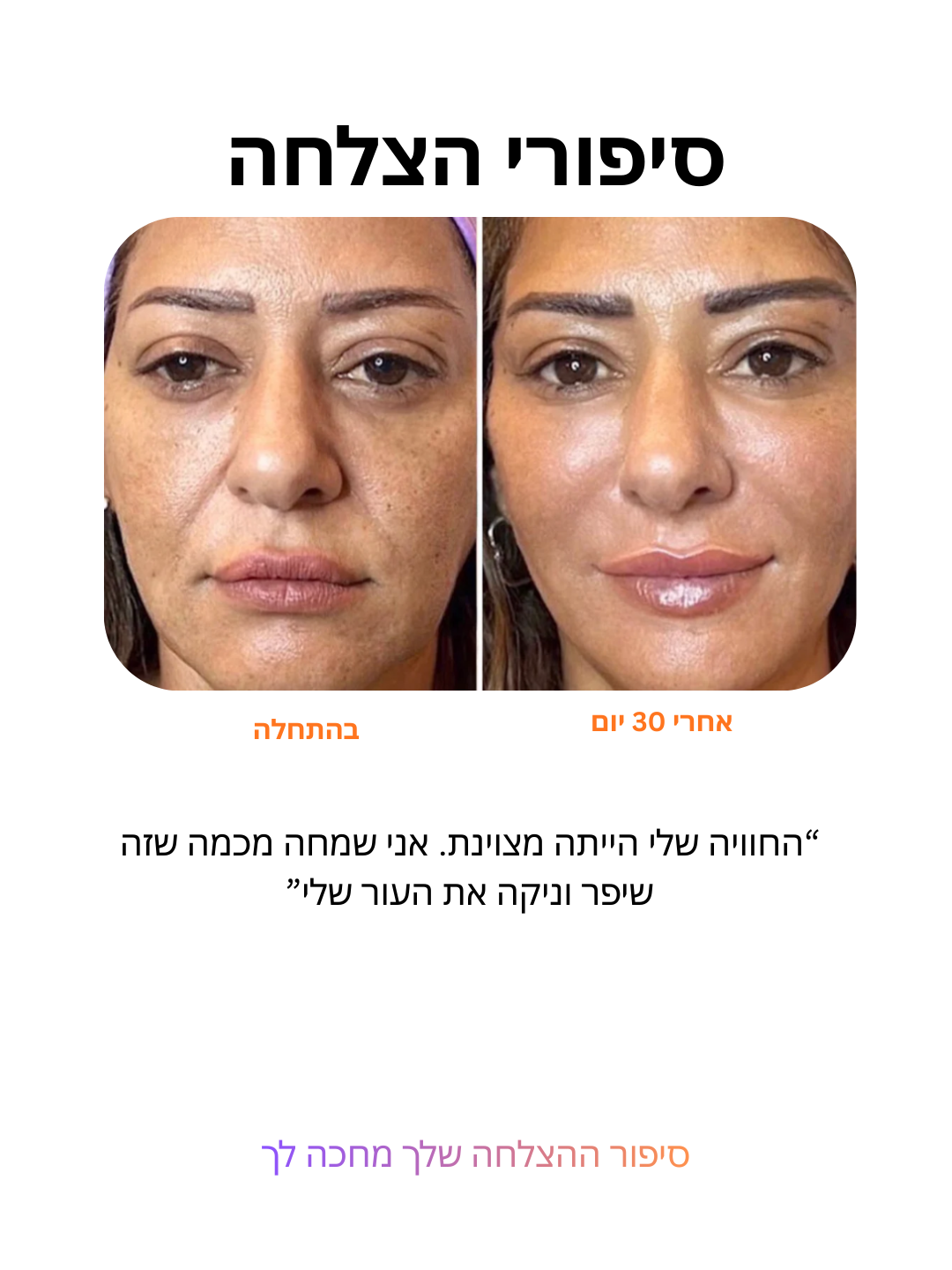 מערכת עירוי מיקרו