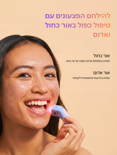 ביי אקנה: טיפול בפצעונים ב-3 דקות