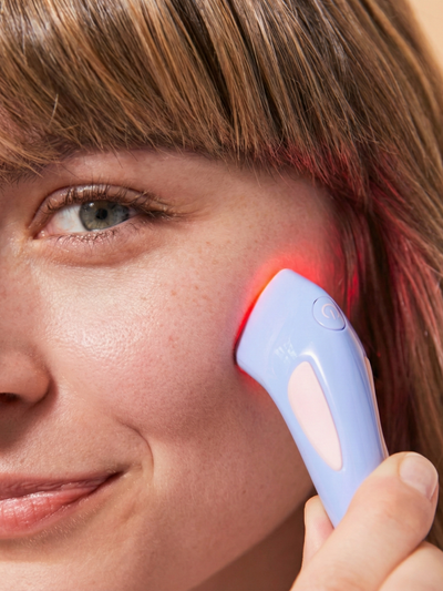 ביי אקנה: טיפול בפצעונים ב-3 דקות