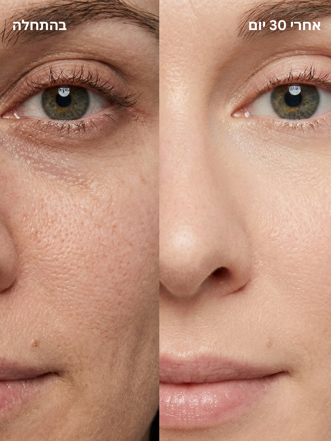 מקל טיפוח עור 4 ב-1