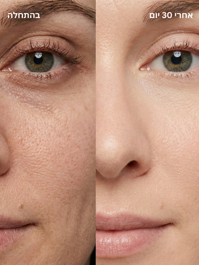 מקל טיפוח עור 4 ב-1