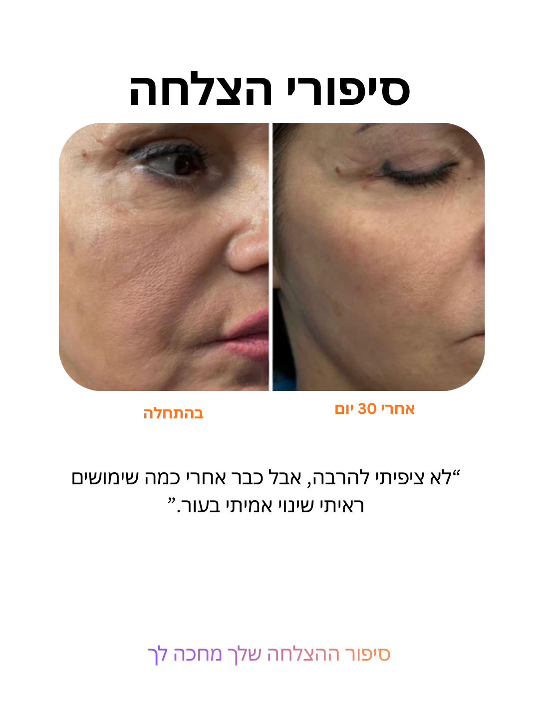 מערכת עירוי מיקרו 