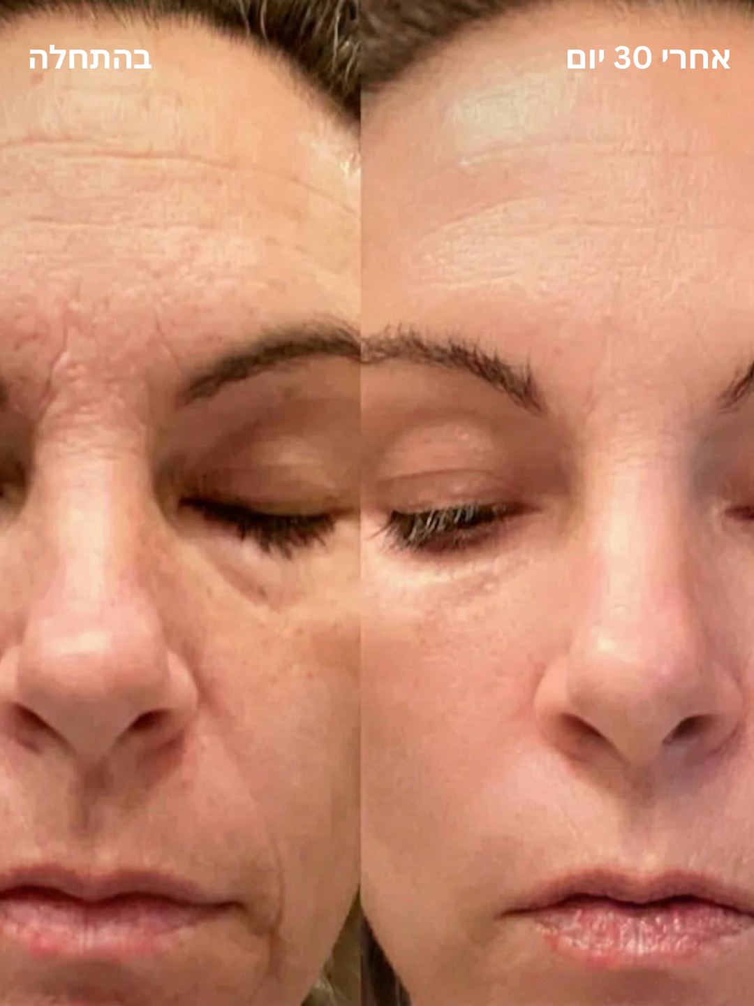 מקל טיפוח עור 4 ב-1