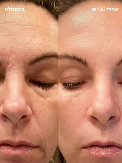 מקל טיפוח עור 4 ב-1